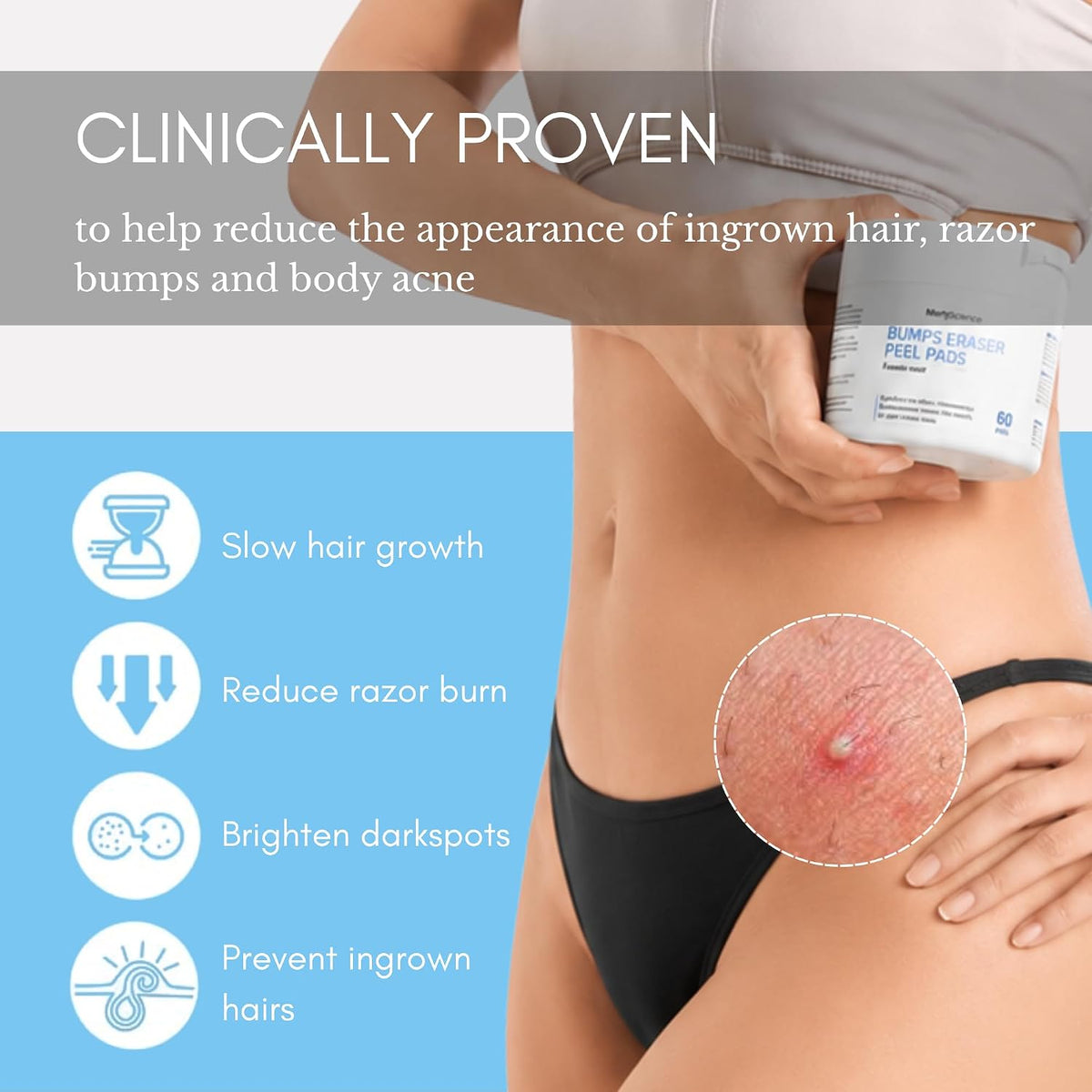 Ingrown Hair Pads for Face & Body, 12% AHA BHA Exfoliating Wipes