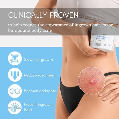 Ingrown Hair Pads for Face & Body, 12% AHA BHA Exfoliating Wipes