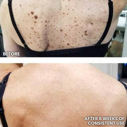 SK Texture Refining Body Serum