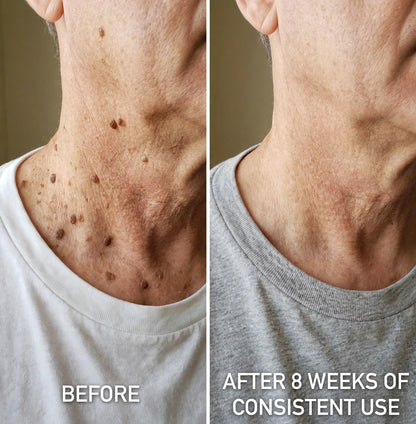 SK Texture Refining Body Serum