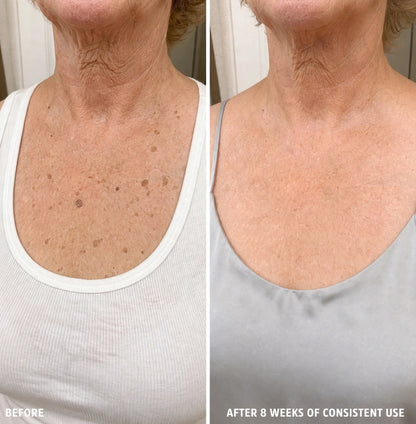 SK Texture Refining Body Serum